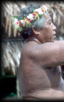 Island Hospitality